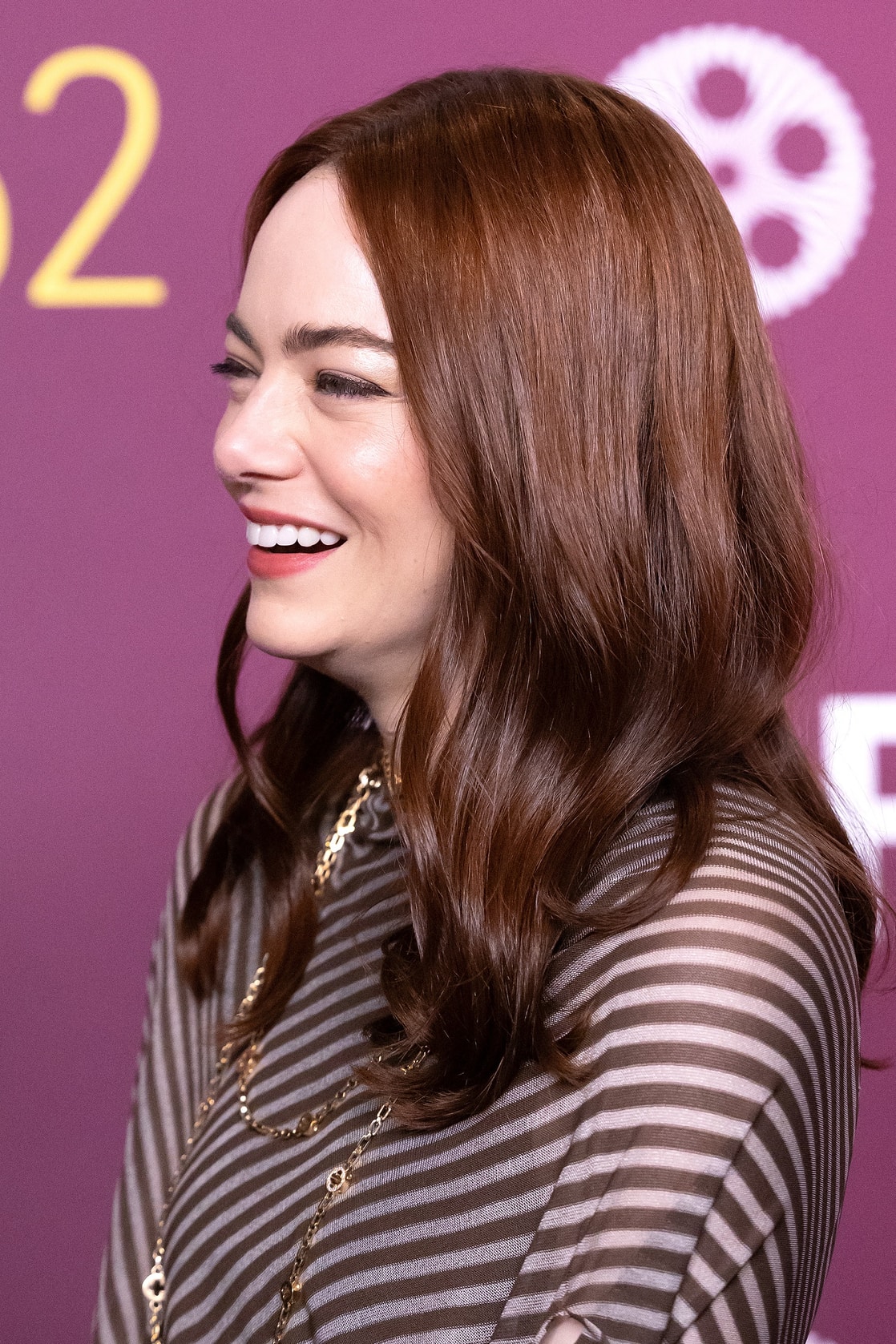 Emma Stone